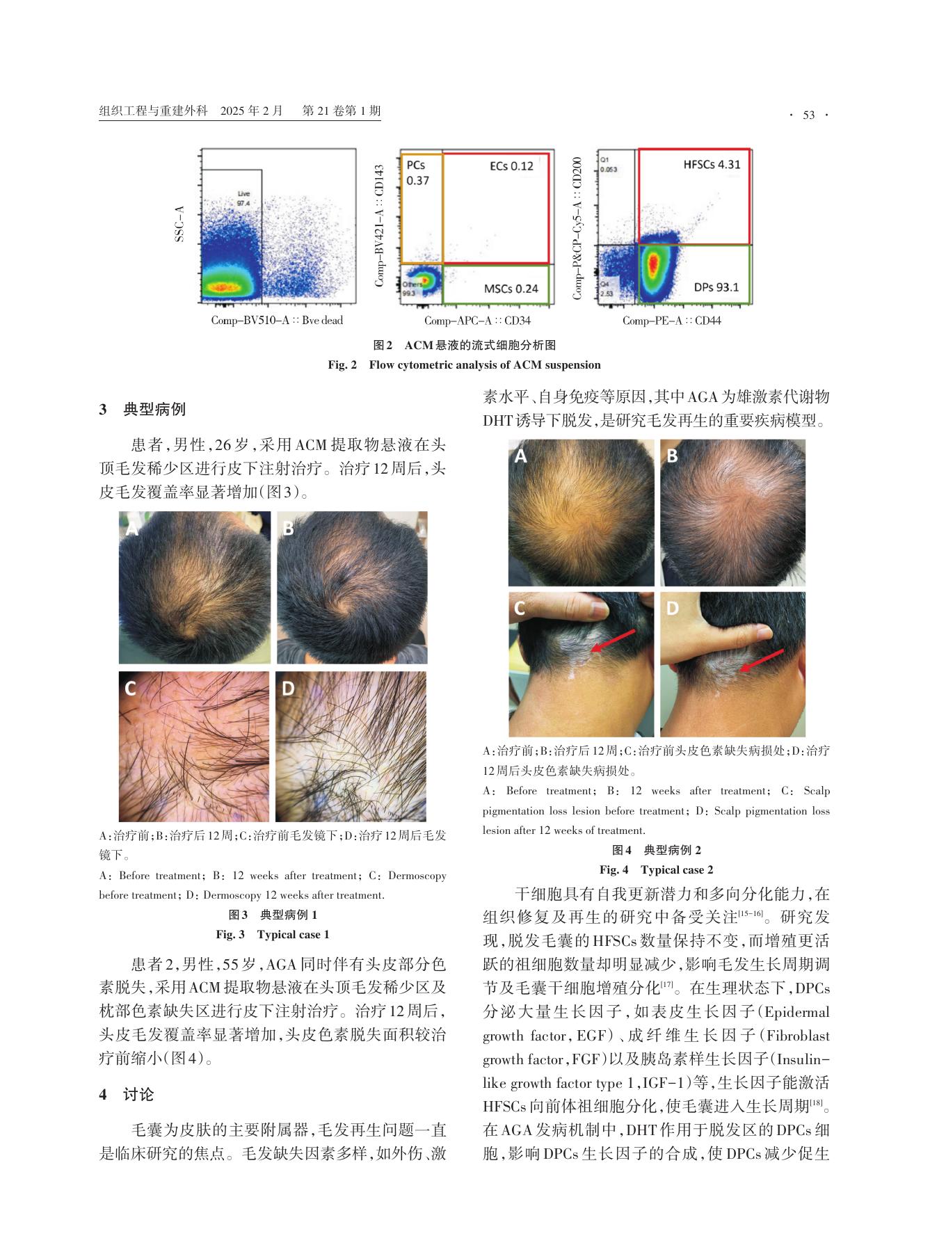 上海九院研究中的皮肤镜前后对比